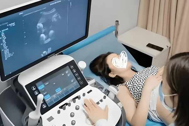 孕12周做10次nt宝宝都不配合怎么做才能顺利通过该检查？