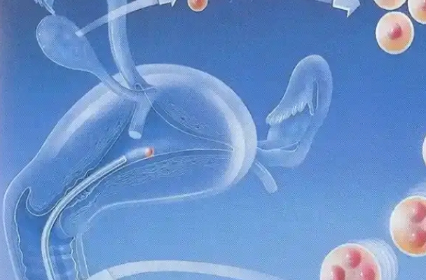 移植后胚胎会寻找着床的地点
