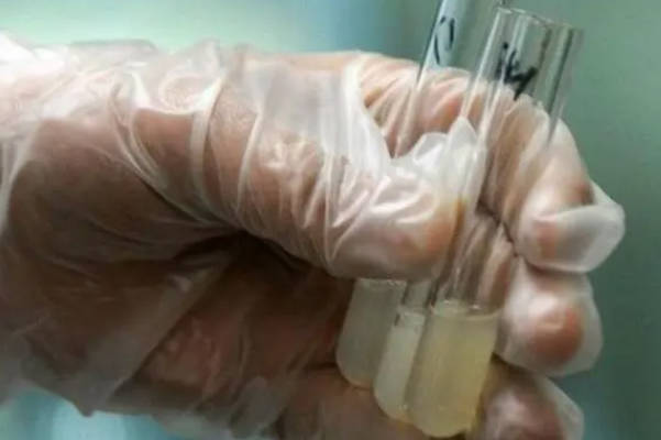 提高男性精子质量可增加怀孕概率