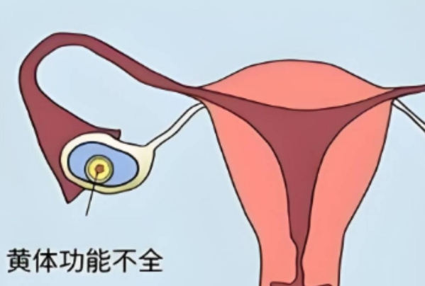 黄体功能不足会影响怀孕