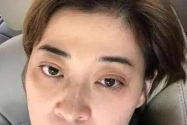 长期禁欲的女性易长黑眼圈