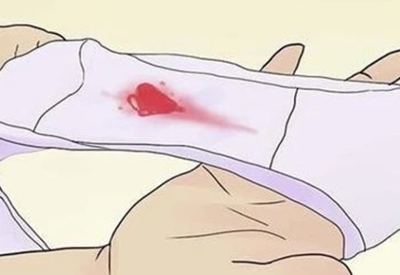 激素水平下降导致黄体期出血