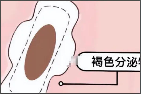 胚胎着床出血会有褐色分泌物