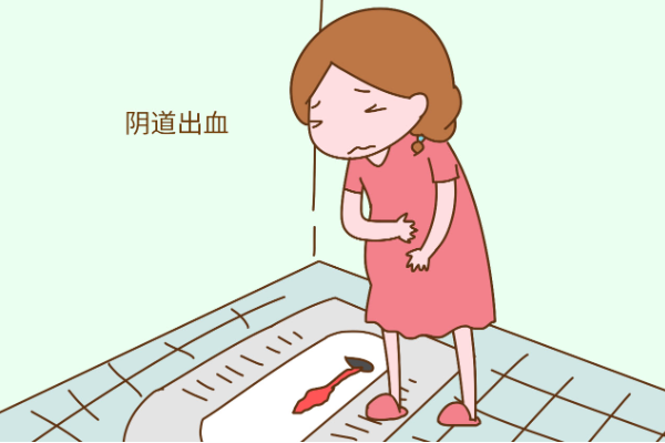 受精卵着床会出现轻微出血