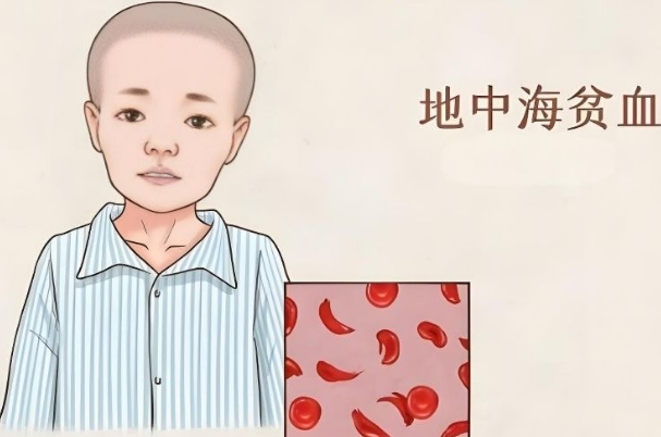 地贫夫妻是自己怀还是做试管，建议选择胚胎移植技术
