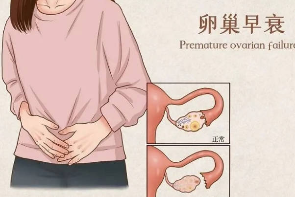 卵巢早衰做试管婴儿1-3次能成功