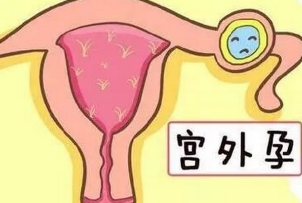 宫外孕真实经历分享，看看hcg变化就能知道