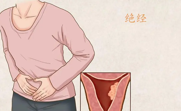 女人40岁就绝经了是不是寿命不长了呀?