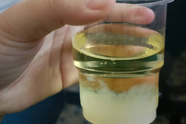 尿里加牙膏测男女真的准，掌握方法在家就能看性别
