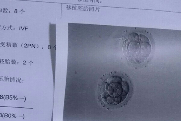 胚胎和囊胚培养时间不一样