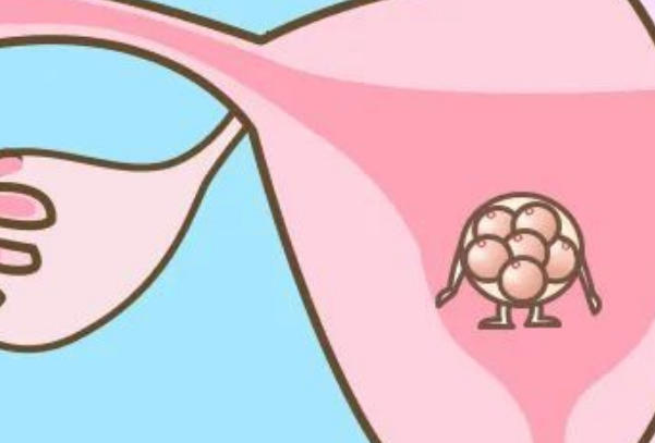 胚胎移植选择类型因人而异