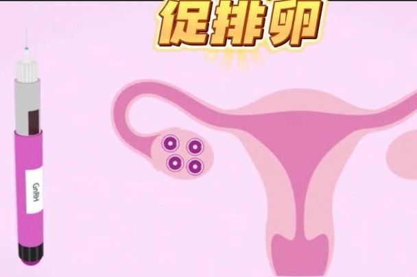 试管促排卵药物可以促进多个卵泡发育