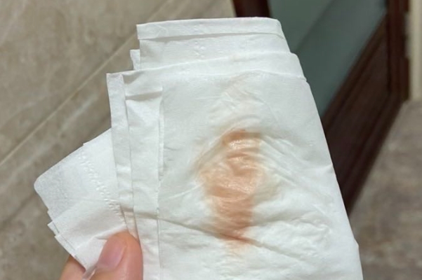 着床出血量通常非常少