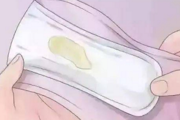 女生白带发黄在内裤上干了像一层壳是怎么回事呢?