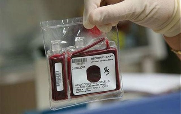 脐带血在公立医院连续保存20年要多少钱呢？
