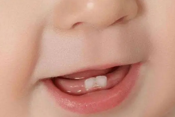 6个月大的宝宝最近老是乱嚼东西是长牙期闹夜的症状之一吗？