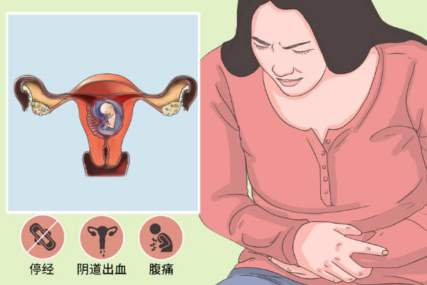子宫偏小的女性不仅怀孕率低