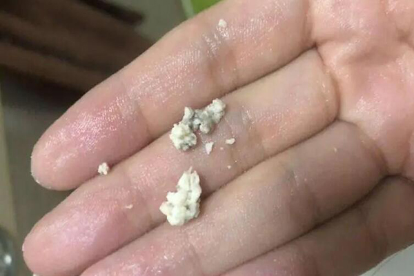 雪诺酮药渣两天清理一次