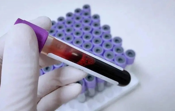 怀孕4周β-hcg正常值参考范围是多少呢？