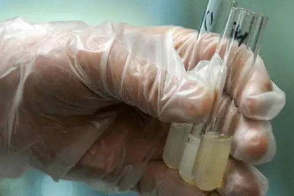 精子库申请精子费用大概是4000元