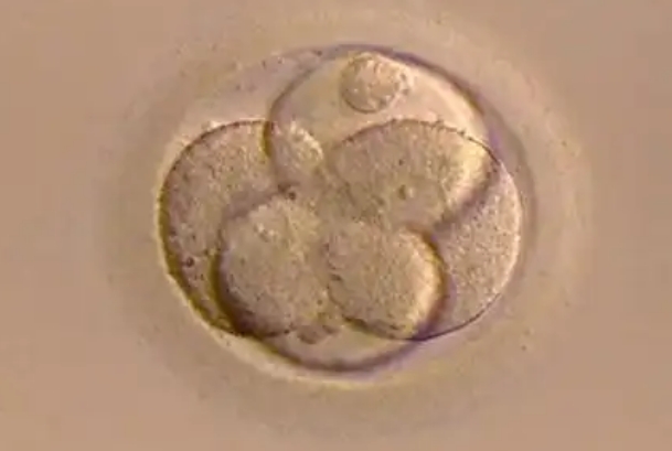 精子DNA碎片率会引起胚胎分裂