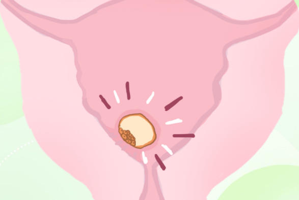 胚胎着床后没有感觉是正常的