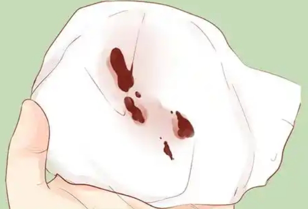 胚胎着床后会轻微出血
