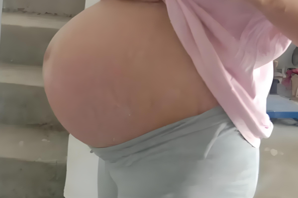 怀男宝的肚子更尖锐