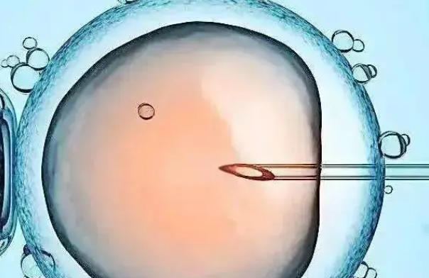 试管婴儿周期全攻略，一步步带你了解怎么期