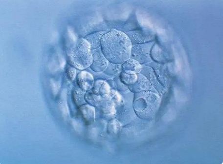 [13-三体综合征患者想要孩子可以做试管婴儿吗?]