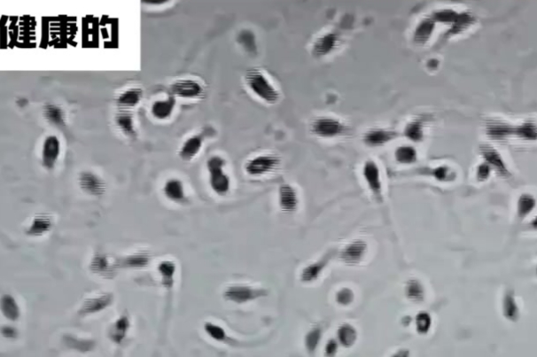 备孕男人吃什么补精？科学饮食提升精子质量全攻略