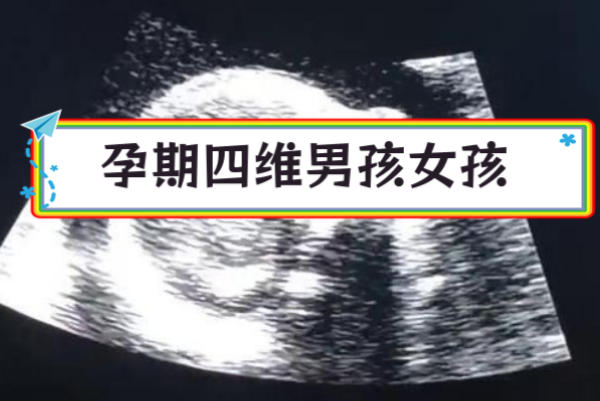 胎儿的性别是由精子的性染色体决定