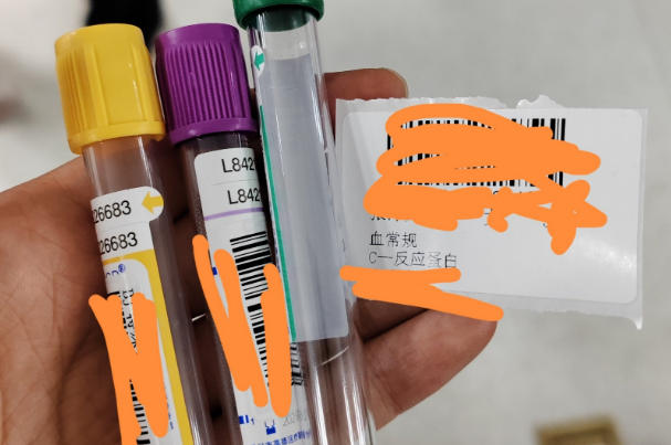 标准试管顺序能降低错误率