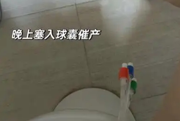 塞球囊的痛相当于几指痛，一般是2到3指具体的因人而异