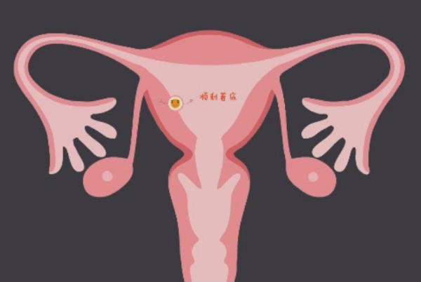 胚胎移植后有可能怀上双胎