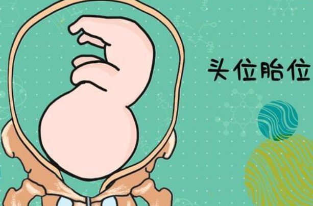宝宝头位姿势图片是怎样的？