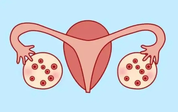 23岁女性输卵管堵塞做一代试管可以放两个胚胎怀双胞胎吗？