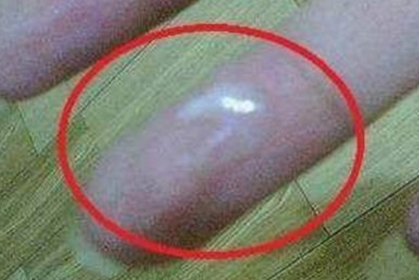排卵分泌物颜色呈乳白色
