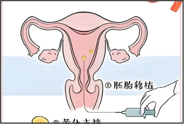 试管移植期间不建议同房