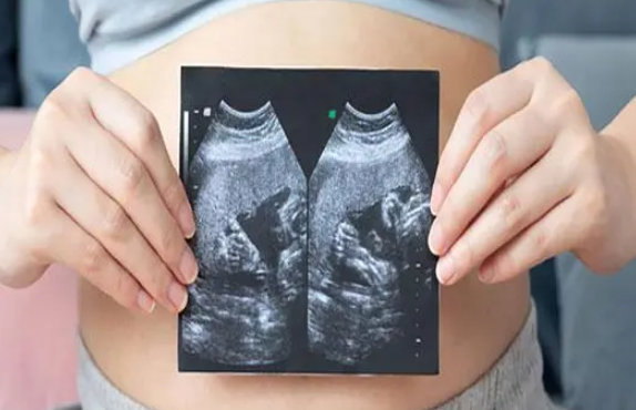 146cm的小个子可以通过试管婴儿移植双胞胎吗？