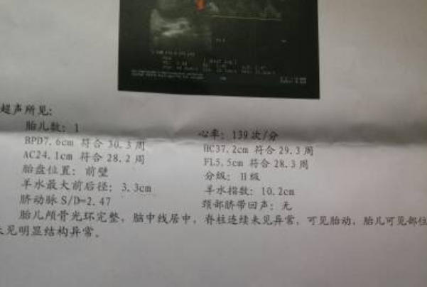 通过bpdhcacfl值可查看胎儿发育情况