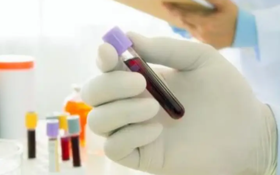 hcg指的是人绒毛膜促性腺激素