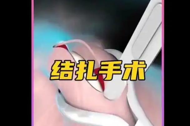结扎了依然可以做试管婴儿
