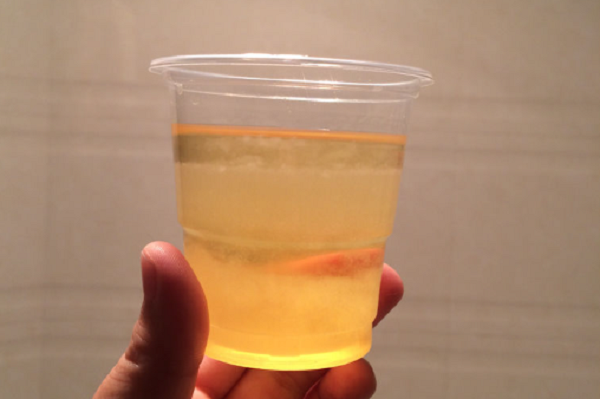 尿中放酒精有分层说明怀的是男娃