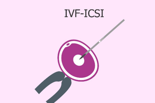 试管婴儿流程步骤分析，一步步带你了解全过程