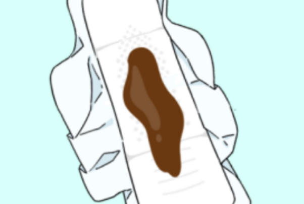 移植后褐色分泌物可能是着床信号