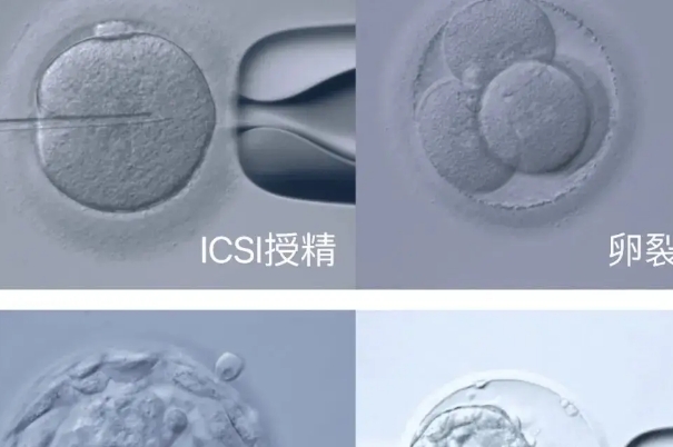 刚满49岁的高龄女人还能做试管生育一个健康宝宝吗？