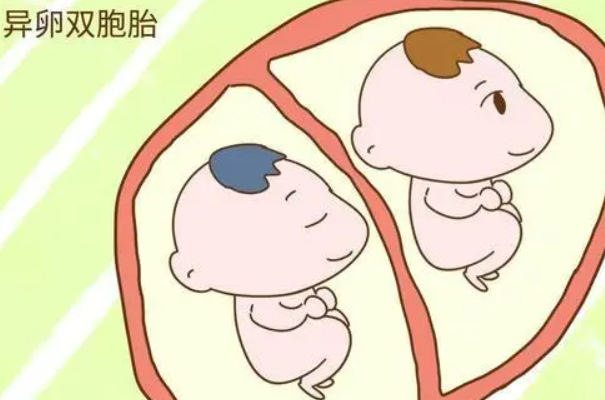 异卵双胎宝宝长大后从面貌上看长得像不像？