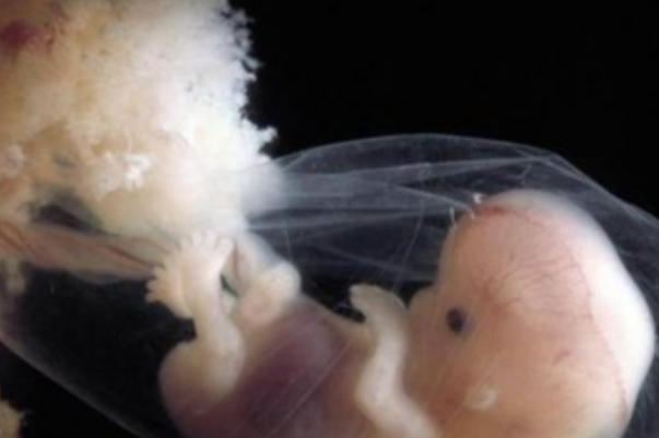 囊胚性别是由精子染色体决定的