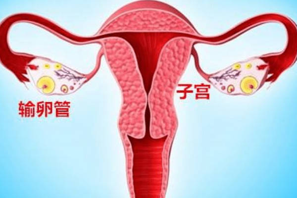 输卵管粘连会导致月经不调